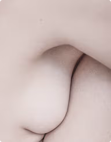 Breast Regenerative Surgery