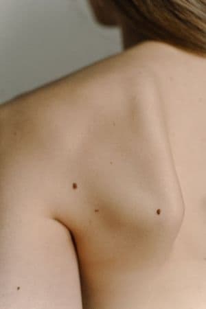 Dermatological Consultation