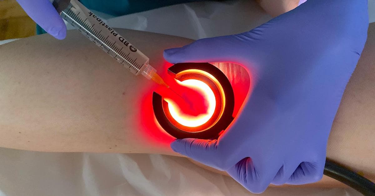 TRAP: Three-dimensional Regenerative Ambulatory Phlebotherapy