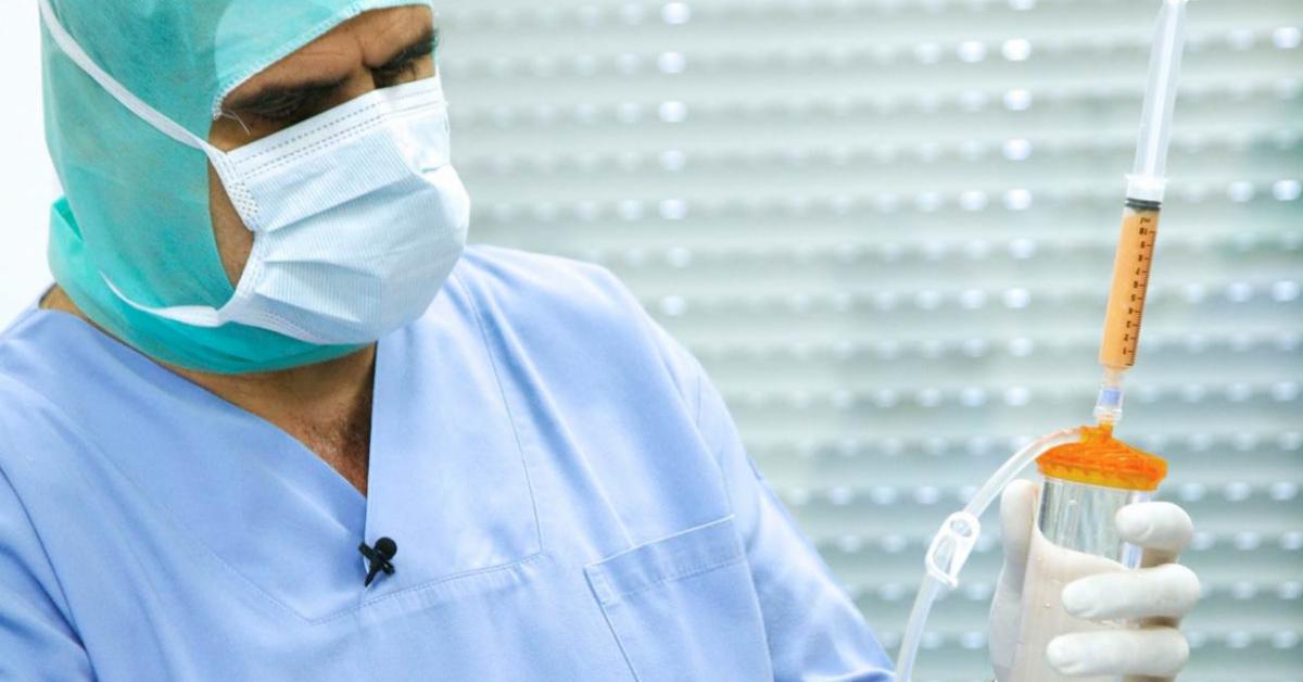 Lipogems: Thousands of Orthopedic Patients Can Benefit from FDA-Cleared Technology Using Their Own Body Fat